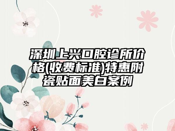 深圳上兴口腔诊所价格(收费标准)特惠附瓷贴面美白案例