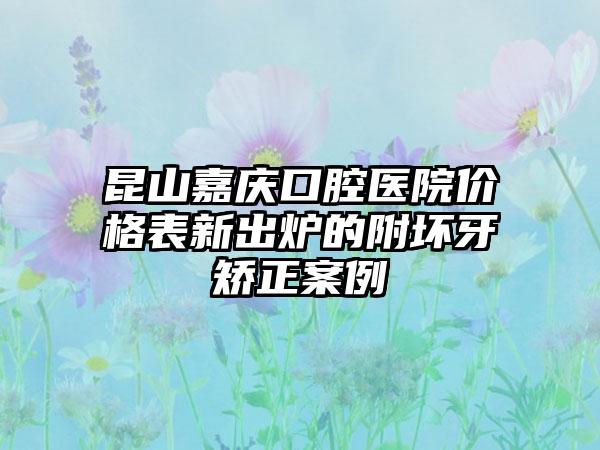昆山嘉庆口腔医院价格表新出炉的附坏牙矫正案例