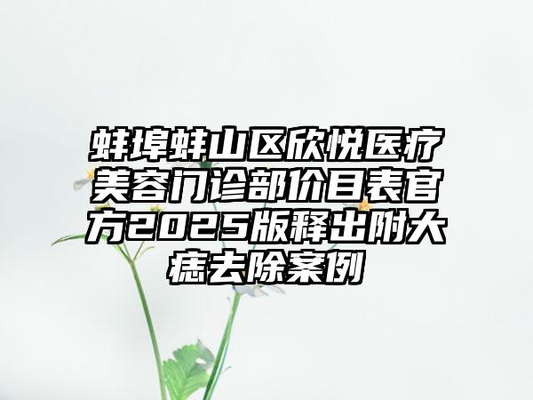 蚌埠蚌山区欣悦医疗美容门诊部价目表官方2025版释出附大痣去除案例