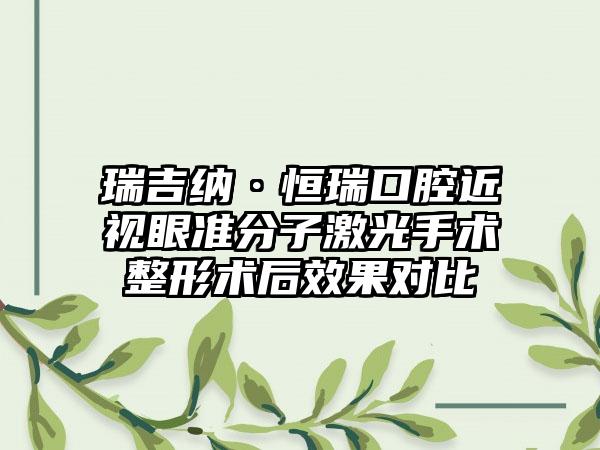 瑞吉纳·恒瑞口腔近视眼准分子激光手术整形术后效果对比