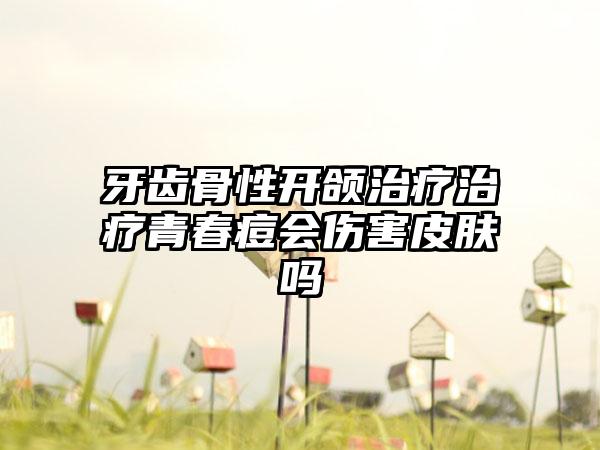 牙齿骨性开颌治疗治疗青春痘会伤害皮肤吗