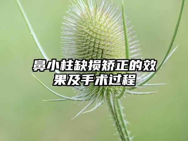 鼻小柱缺损矫正的效果及手术过程