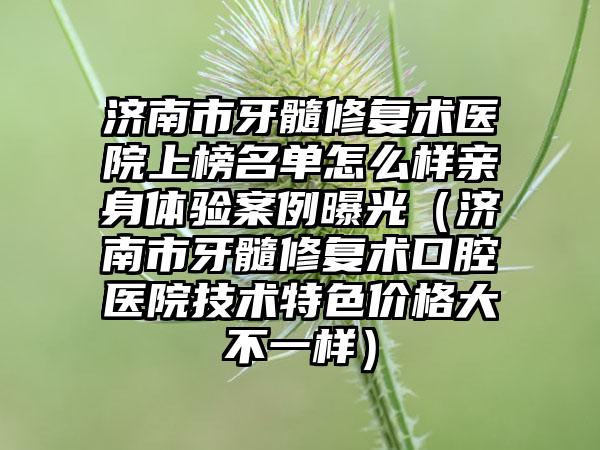济南市牙髓修复术医院上榜名单怎么样亲身体验案例曝光（济南市牙髓修复术口腔医院技术特色价格大不一样）