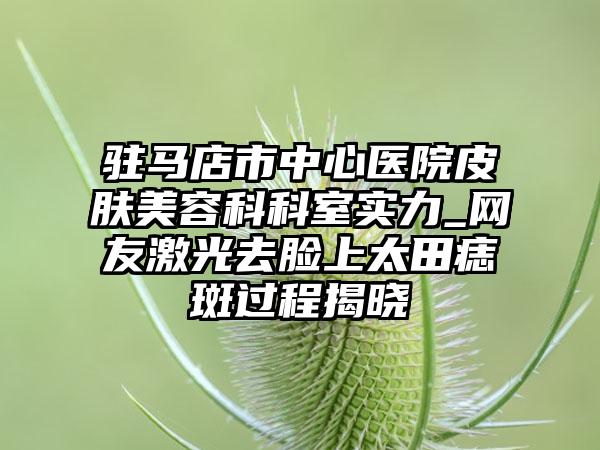 驻马店市中心医院皮肤美容科科室实力_网友激光去脸上太田痣斑过程揭晓