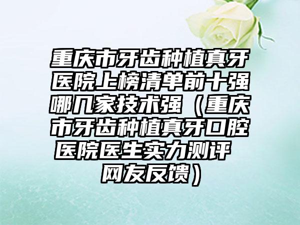 重庆市牙齿种植真牙医院上榜清单前十强哪几家技术强（重庆市牙齿种植真牙口腔医院医生实力测评 网友反馈）