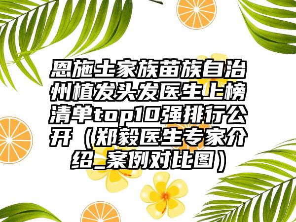 恩施土家族苗族自治州植发头发医生上榜清单top10强排行公开（郑毅医生专家介绍_案例对比图）