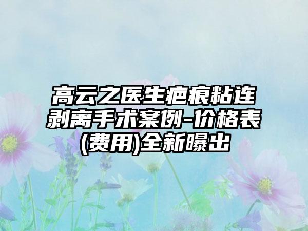 高云之医生疤痕粘连剥离手术案例-价格表(费用)全新曝出