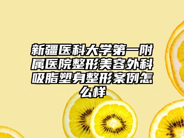 新疆医科大学第一附属医院整形美容外科吸脂塑身整形案例怎么样