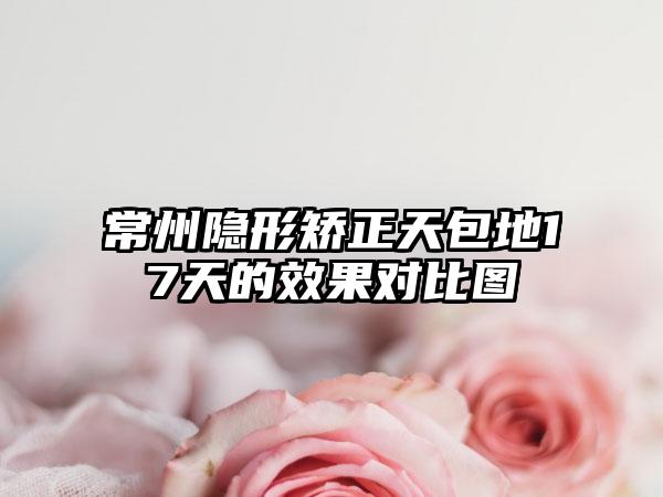 常州隐形矫正天包地17天的效果对比图