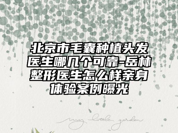 北京市毛囊种植头发医生哪几个可靠-岳林整形医生怎么样亲身体验案例曝光